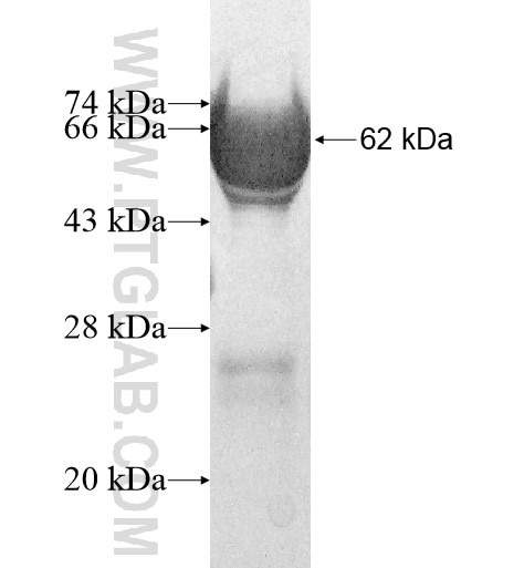 Peripherin fusion protein Ag11365 SDS-PAGE