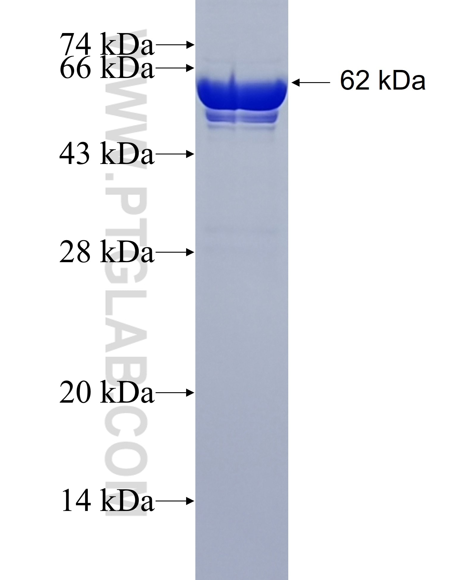 Peripherin fusion protein Ag11365 SDS-PAGE