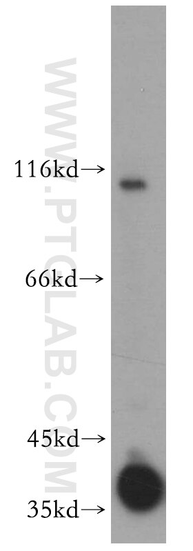 Western Blot (WB) analysis of mouse eye tissue using PRPH2 Polyclonal antibody (18109-1-AP)