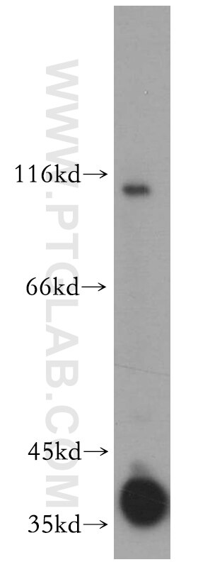 WB analysis of mouse eye using 18109-1-AP