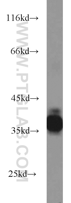 Western Blot (WB) analysis of mouse eye tissue using PRPH2 Polyclonal antibody (18109-1-AP)