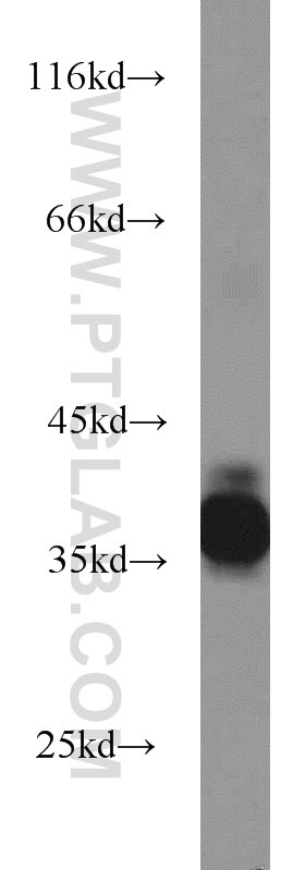 WB analysis of mouse eye using 18109-1-AP