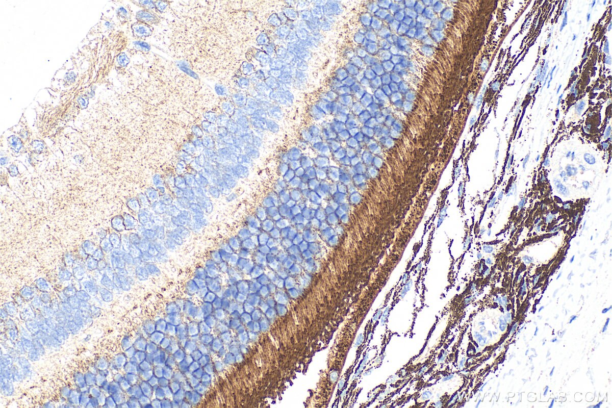 Immunohistochemistry (IHC) staining of mouse eye tissue using PRPH2 Monoclonal antibody (68780-1-Ig)
