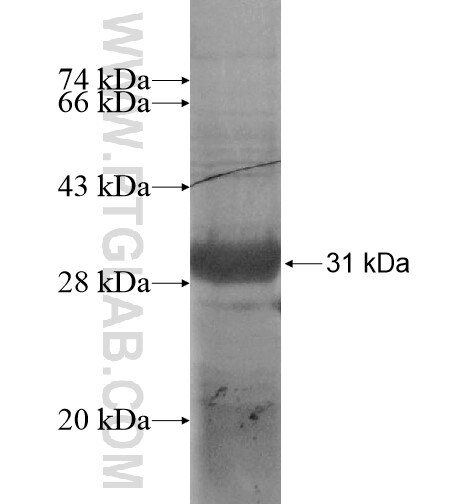PRPH2 fusion protein Ag12555 SDS-PAGE