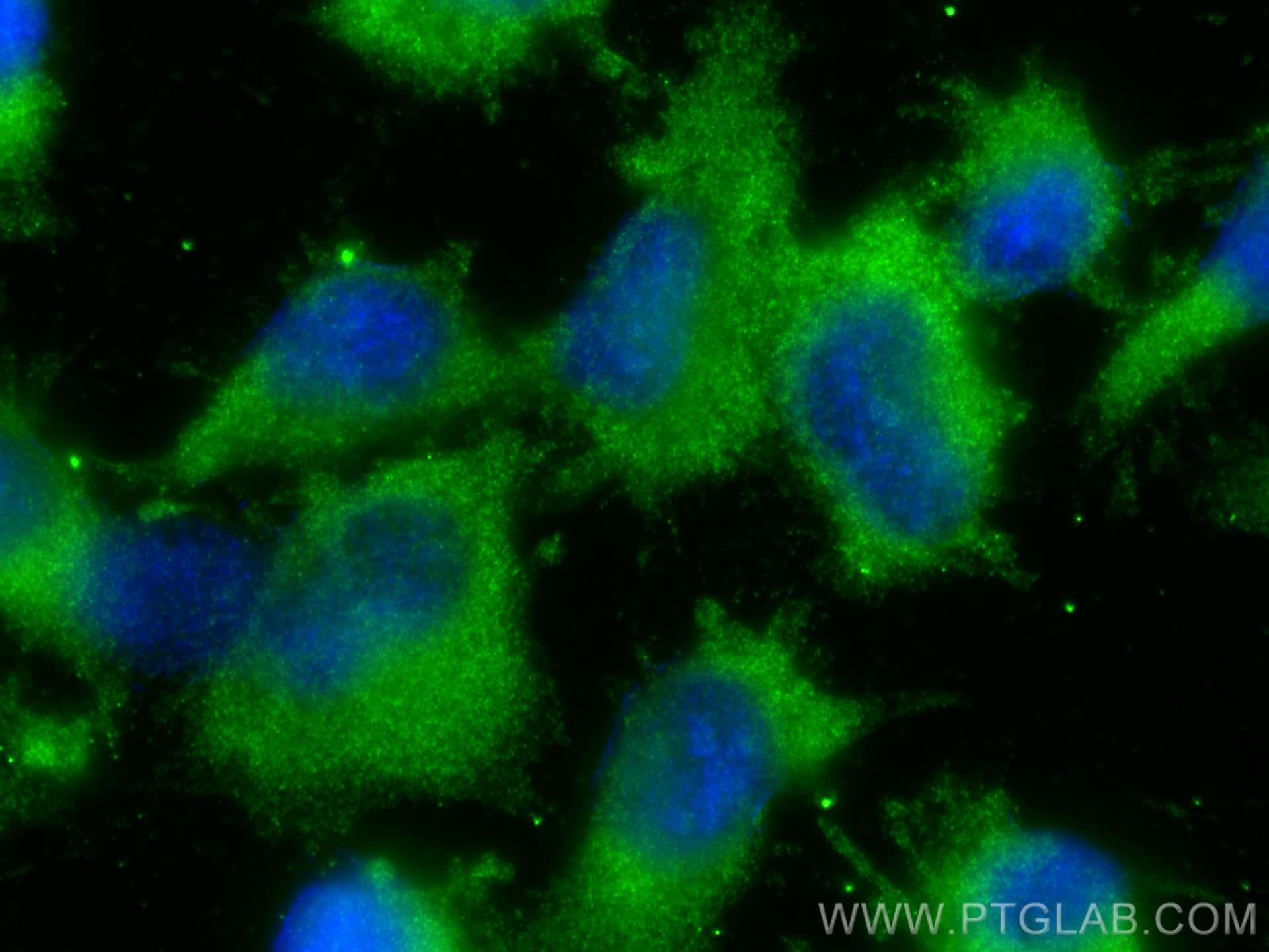 Immunofluorescence (IF) / fluorescent staining of U-251 cells using PRPS1 Polyclonal antibody (15549-1-AP)