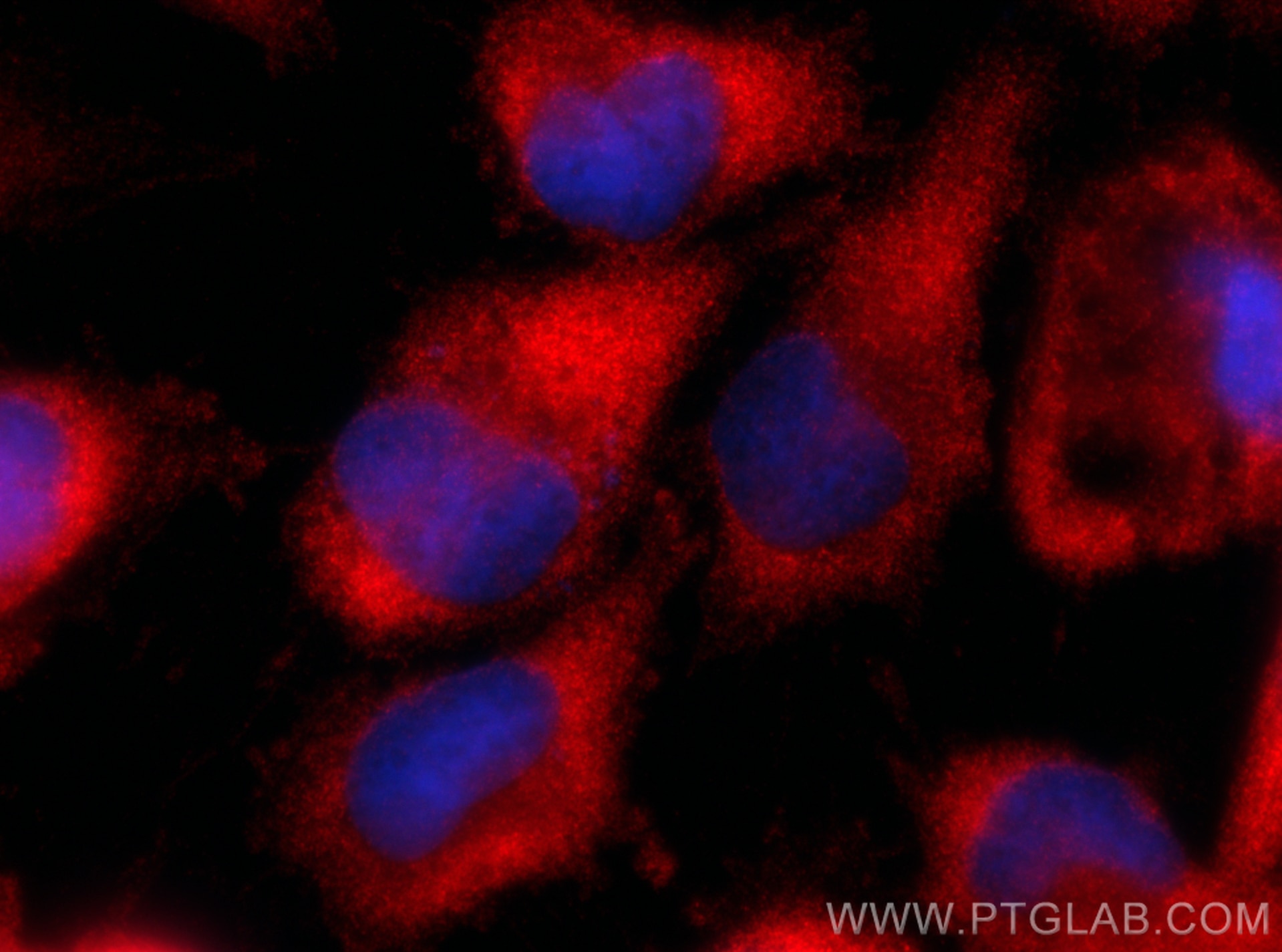 Immunofluorescence (IF) / fluorescent staining of U-251 cells using PRPS1 Polyclonal antibody (15549-1-AP)