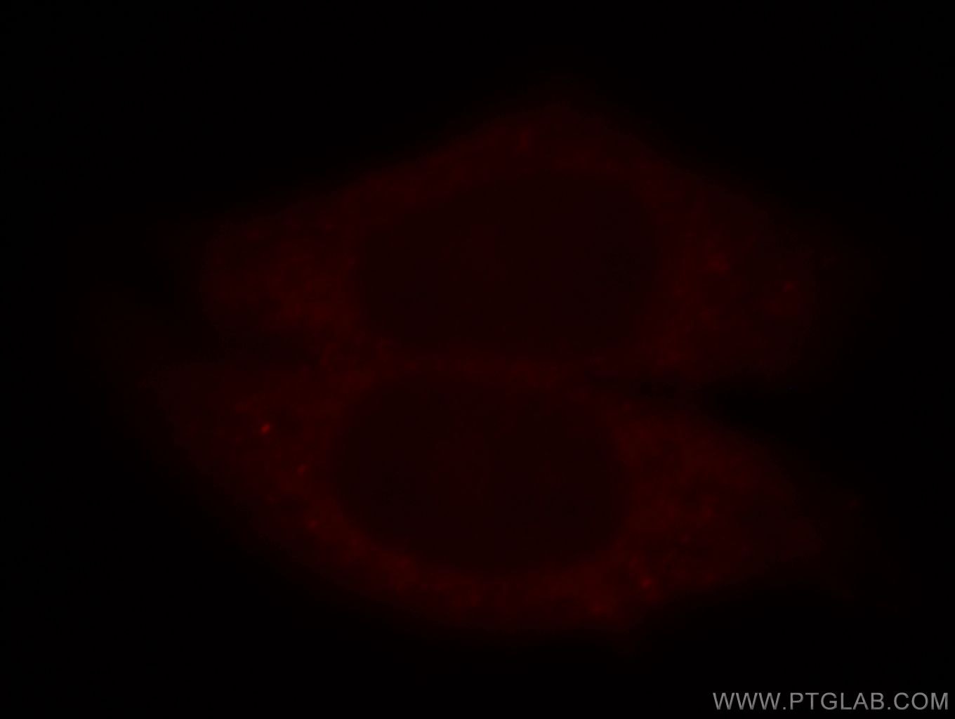 Immunofluorescence (IF) / fluorescent staining of HepG2 cells using PRPS1 Polyclonal antibody (15549-1-AP)