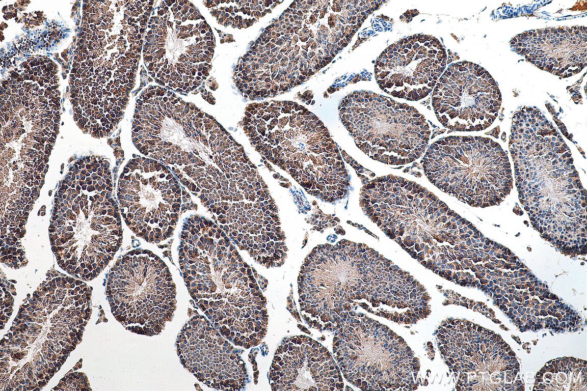 Immunohistochemistry (IHC) staining of mouse testis tissue using PRPS1 Polyclonal antibody (15549-1-AP)
