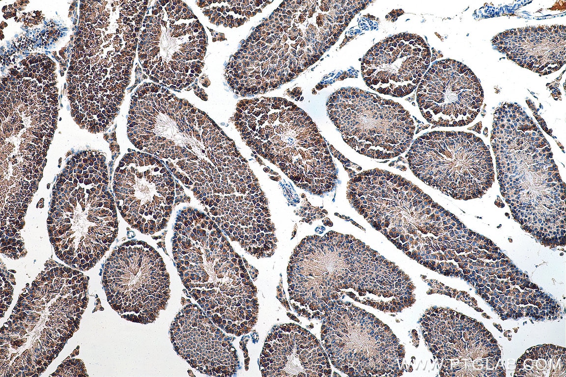 IHC staining of mouse testis using 15549-1-AP