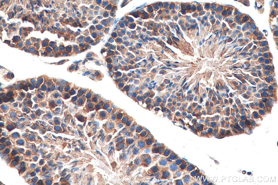 Immunohistochemistry (IHC) staining of mouse testis tissue using PRPS1 Polyclonal antibody (15549-1-AP)