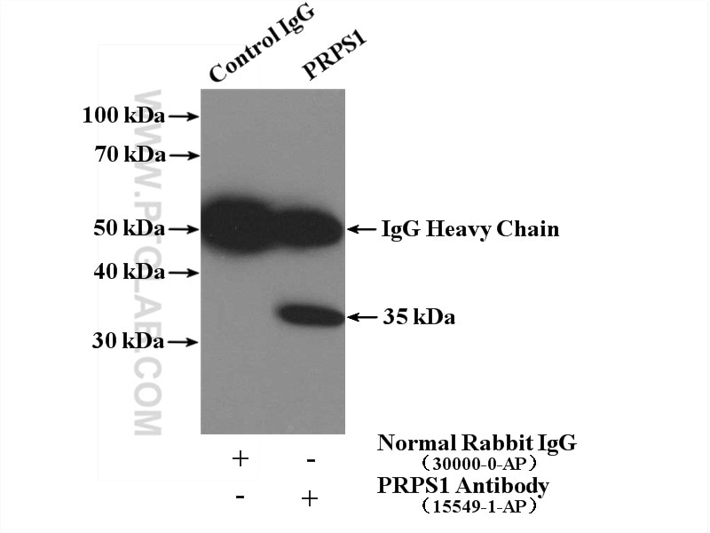 Immunoprecipitation (IP) experiment of HeLa cells using PRPS1 Polyclonal antibody (15549-1-AP)