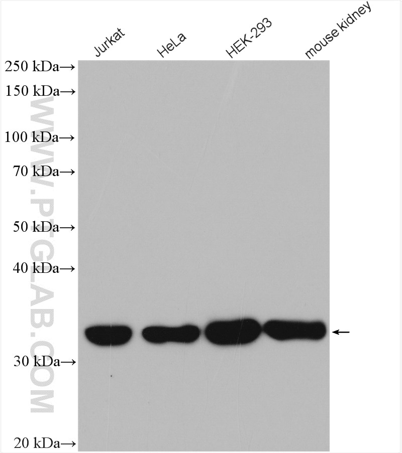 Western Blot (WB) analysis of various lysates using PRPS1 Polyclonal antibody (15549-1-AP)