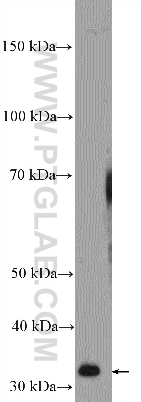 Western Blot (WB) analysis of rat spleen tissue using PRPS1 Polyclonal antibody (15549-1-AP)