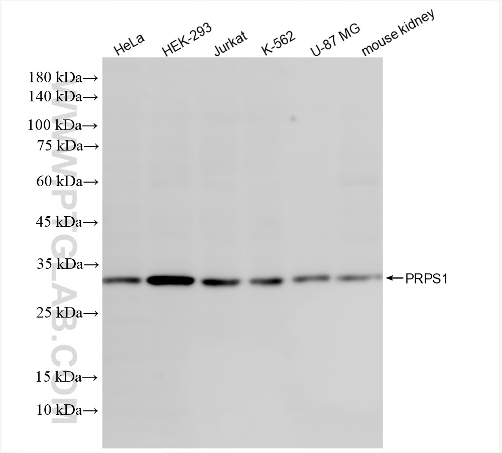 Western Blot (WB) analysis of various lysates using PRPS1 Recombinant antibody (86217-1-RR)