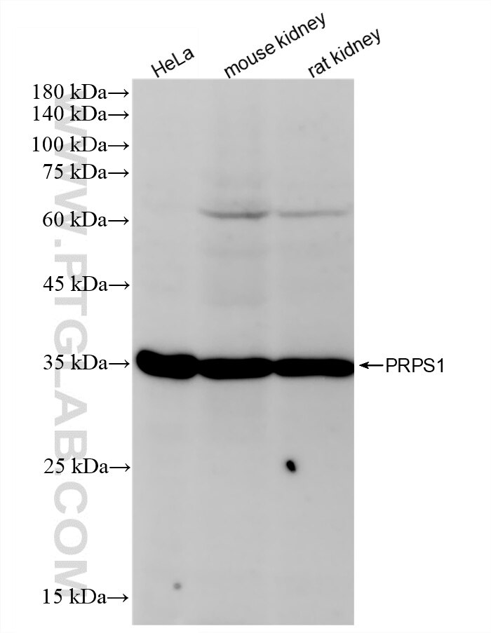 WB analysis using 86217-1-RR (same clone as 86217-1-PBS) Western Blot (WB) analysis of various lysates using PRPS1 Recombinant monoclonal antibody (86217-1-RR)