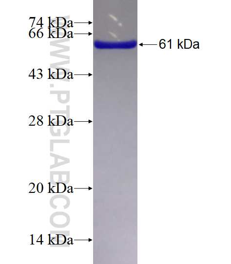 PRPS1 fusion protein Ag7907 SDS-PAGE