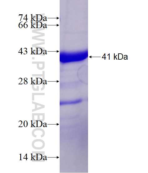 PRPS1 fusion protein Ag8120 SDS-PAGE