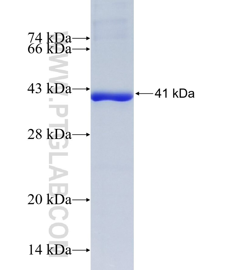 PRPS1 fusion protein Ag8120 SDS-PAGE