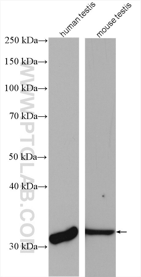 Western Blot (WB) analysis of various lysates using PRPS1L1 Polyclonal antibody (16657-1-AP)