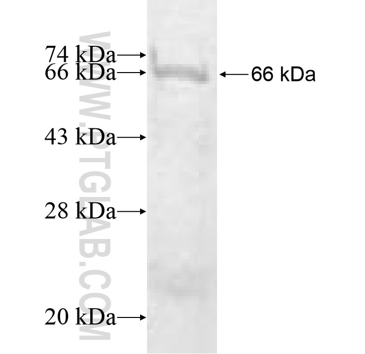 PRPS1L1 fusion protein Ag10111 SDS-PAGE