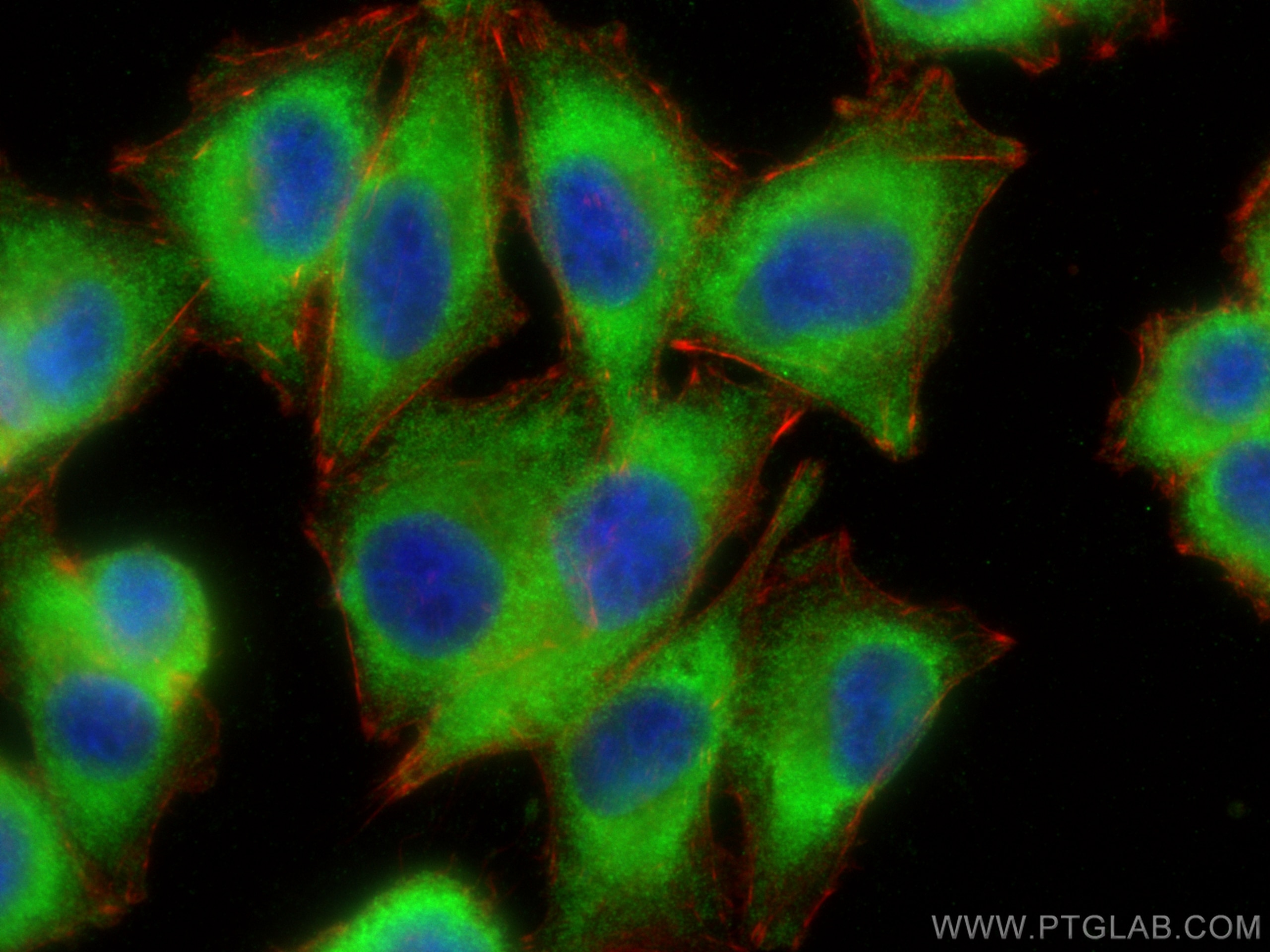 Immunofluorescence (IF) / fluorescent staining of A375 cells using PRPS2 Polyclonal antibody (27024-1-AP)