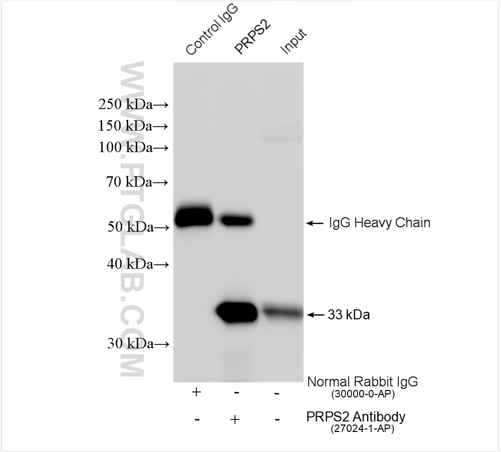 Immunoprecipitation (IP) experiment of A375 cells using PRPS2 Polyclonal antibody (27024-1-AP)