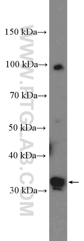 Western Blot (WB) analysis of A375 cells using PRPS2 Polyclonal antibody (27024-1-AP)