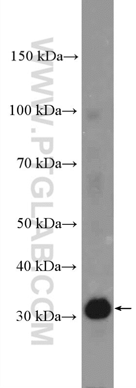 Western Blot (WB) analysis of A375 cells using PRPS2 Polyclonal antibody (27024-1-AP)