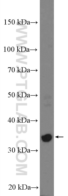 Western Blot (WB) analysis of A375 cells using PRPS2 Polyclonal antibody (27024-1-AP)