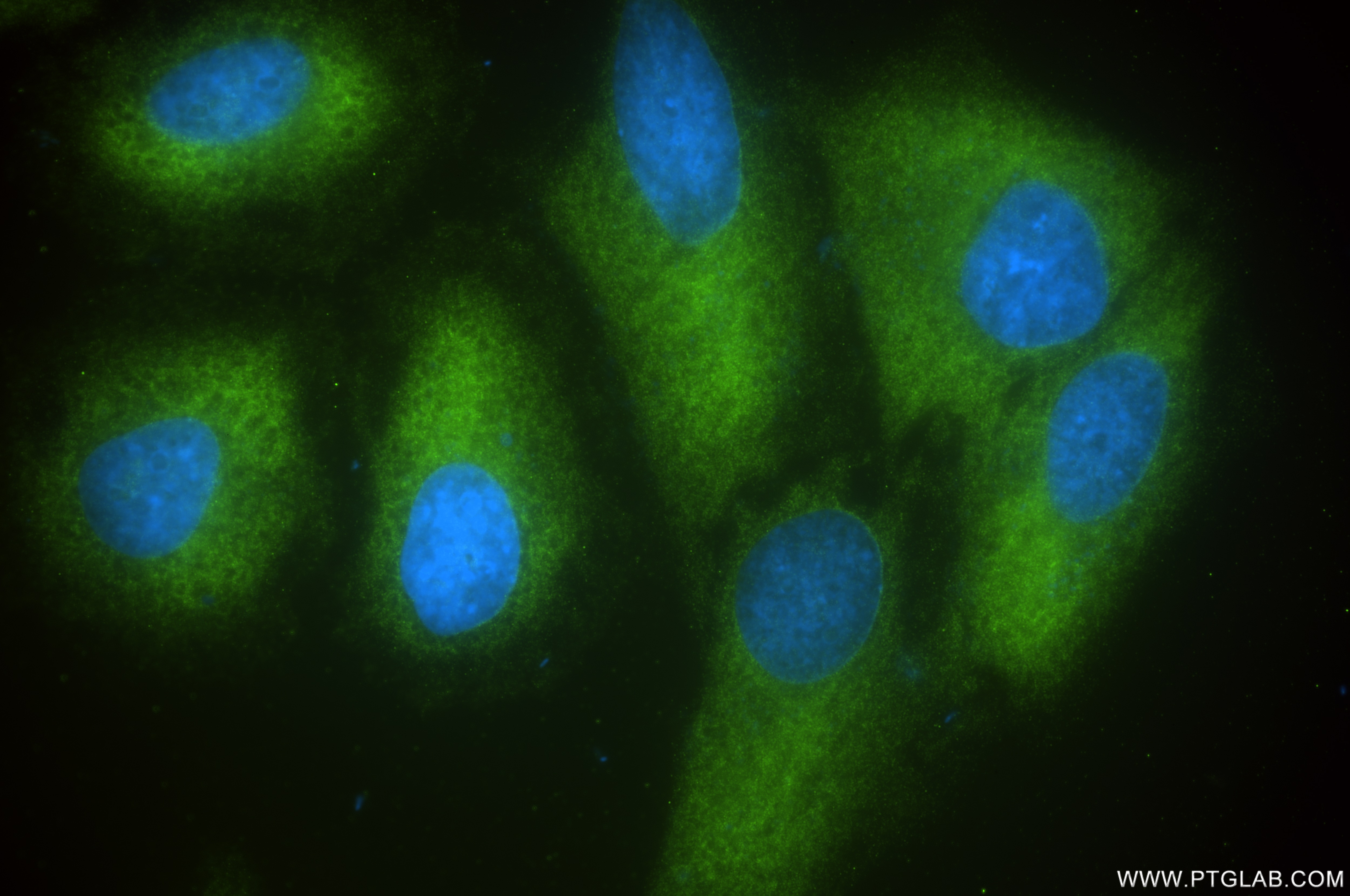Immunofluorescent analysis of (-20°C Ethanol) fixed HeLa cells using PRPS2 antibody (85090-5-RR, Clone: 242657G2 ) at dilution of 1:400 and CoraLite®488-Conjugated Goat Anti-Rabbit IgG(H+L) (SA00013-2). This data was developed using the same antibody clone with 85090-5-PBS in a different storage buffer formulation. Immunofluorescence (IF) / fluorescent staining of HeLa cells using PRPS2 Recombinant monoclonal antibody (85090-5-RR)