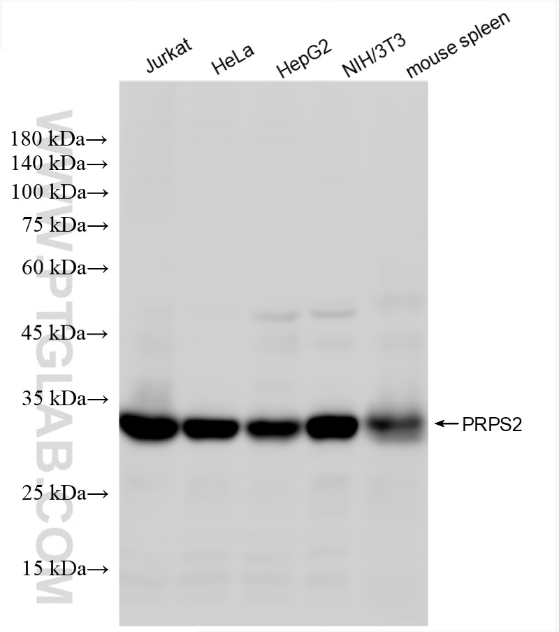 Western Blot (WB) analysis of various lysates using PRPS2 Recombinant antibody (85090-5-RR)