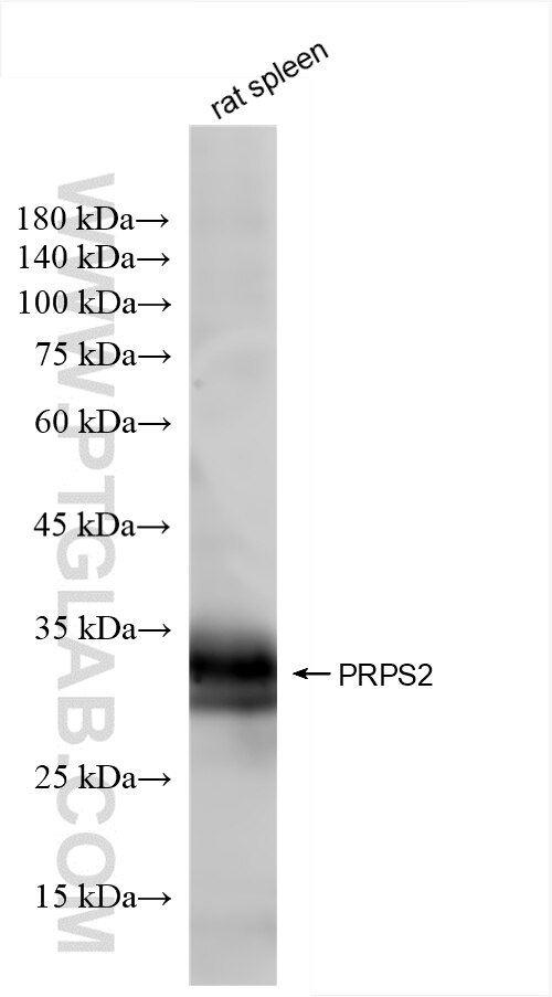 PRPS2