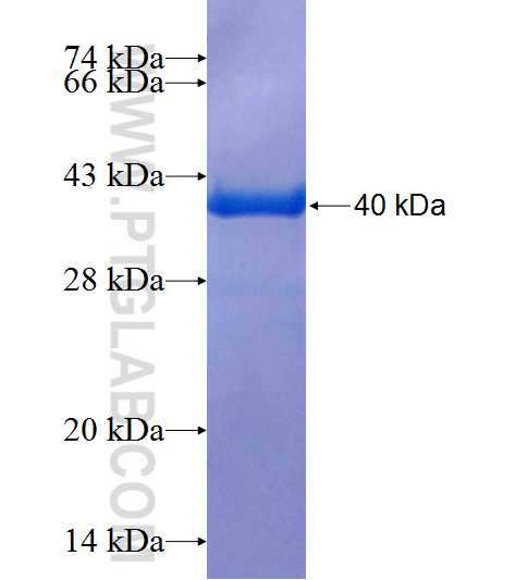 PRPS2 fusion protein Ag25785 SDS-PAGE