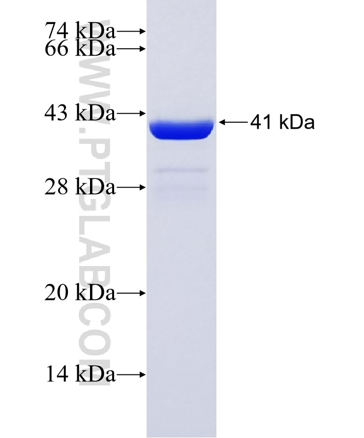 PRPS2 fusion protein Ag25785 SDS-PAGE