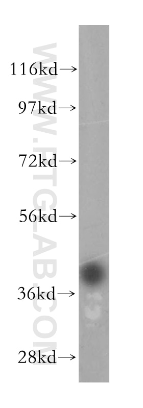 Western Blot (WB) analysis of human testis tissue using PRPSAP1 Polyclonal antibody (16790-1-AP)