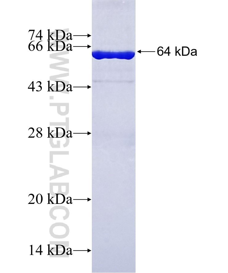 PRPSAP1 fusion protein Ag10227 SDS-PAGE