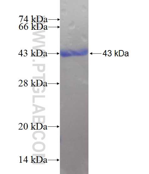 PRPSAP1 fusion protein Ag10238 SDS-PAGE