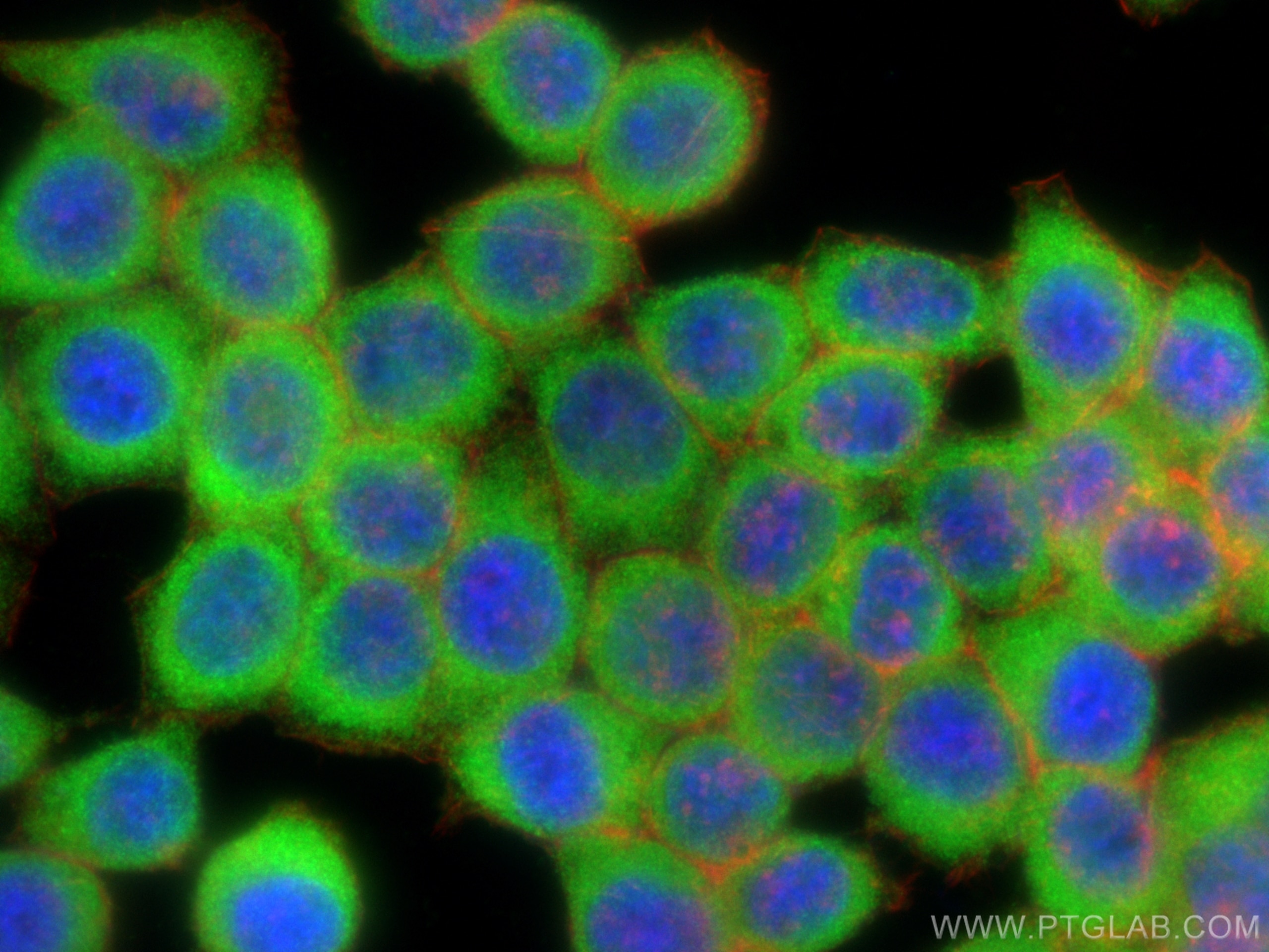 Immunofluorescence (IF) / fluorescent staining of BxPC-3 cells using PRPSAP2 Polyclonal antibody (17814-1-AP)