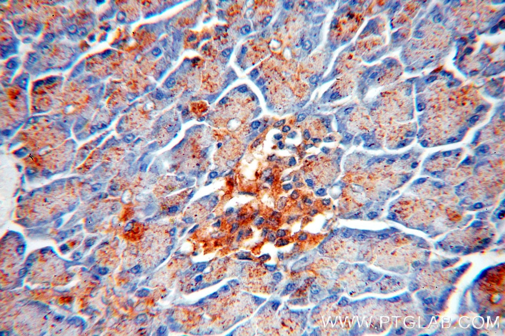 Immunohistochemistry (IHC) staining of human pancreas tissue using PRPSAP2 Polyclonal antibody (17814-1-AP)