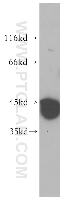 Western Blot (WB) analysis of mouse brain tissue using PRPSAP2 Polyclonal antibody (17814-1-AP)