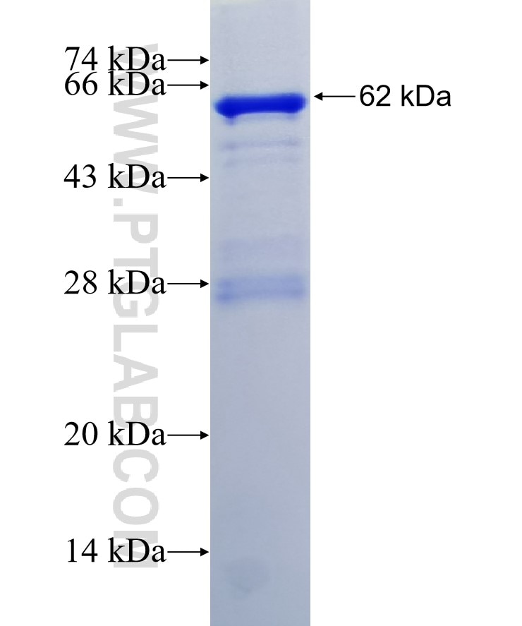 PRPSAP2 fusion protein Ag12132 SDS-PAGE