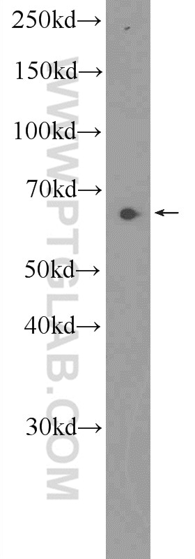 Western Blot (WB) analysis of mouse brain tissue using PRR14 Polyclonal antibody (22819-1-AP)