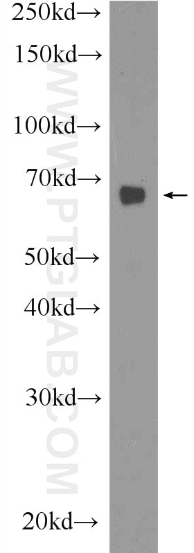 Western Blot (WB) analysis of HL-60 cells using PRR14 Polyclonal antibody (22819-1-AP)