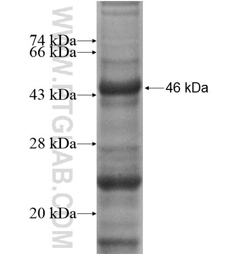 PRR14 fusion protein Ag14119 SDS-PAGE