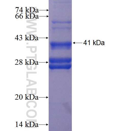 PRR4 fusion protein Ag2589 SDS-PAGE