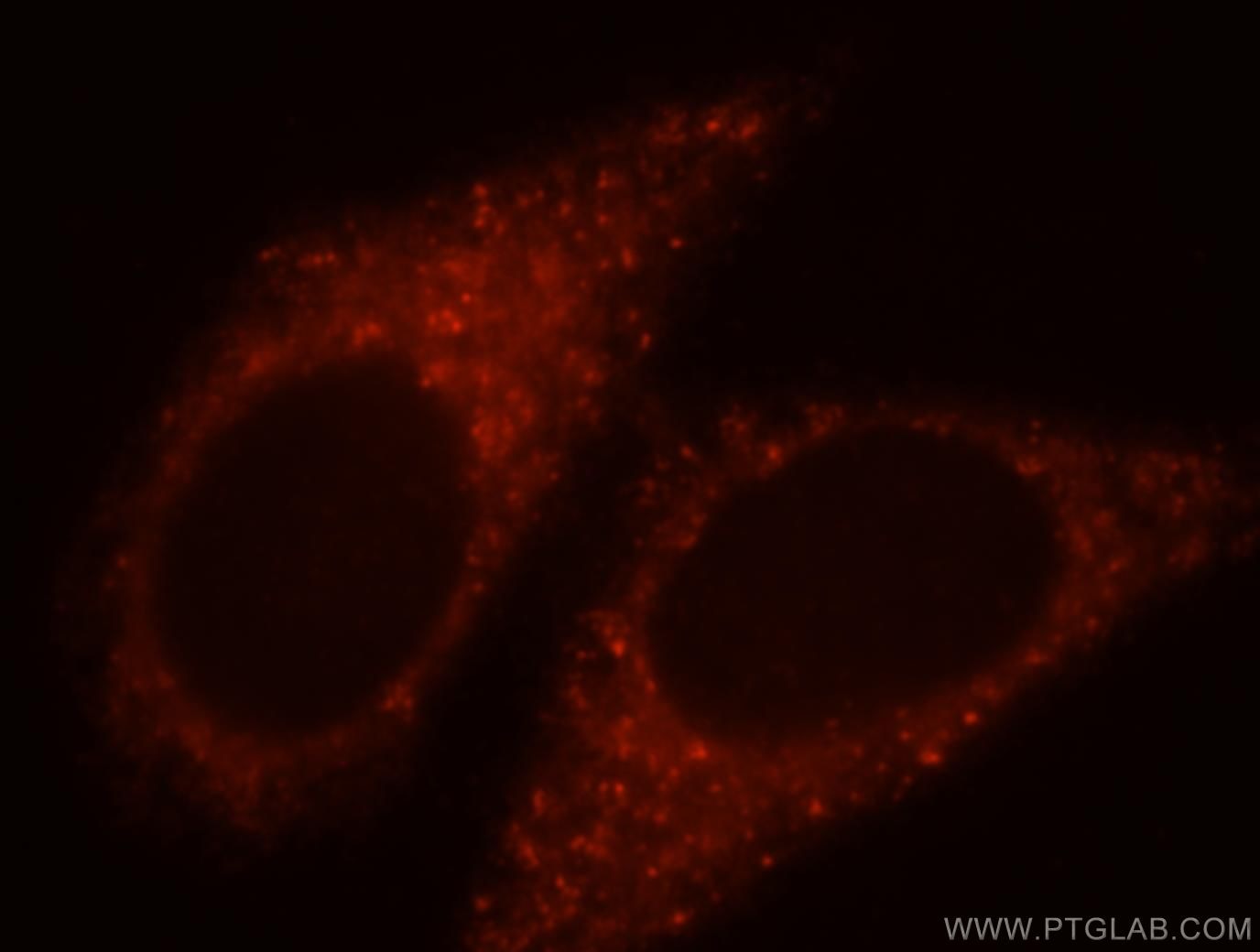 Immunofluorescence (IF) / fluorescent staining of HepG2 cells using PRR5 Polyclonal antibody (17948-1-AP)