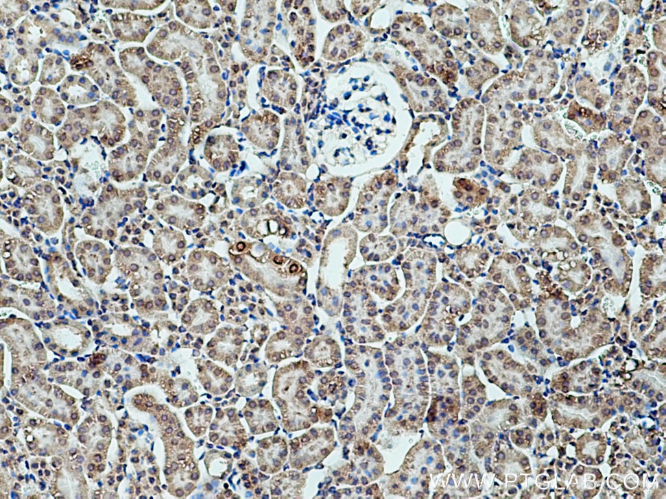 Immunohistochemistry (IHC) staining of mouse kidney tissue using PRR5 Polyclonal antibody (17948-1-AP)