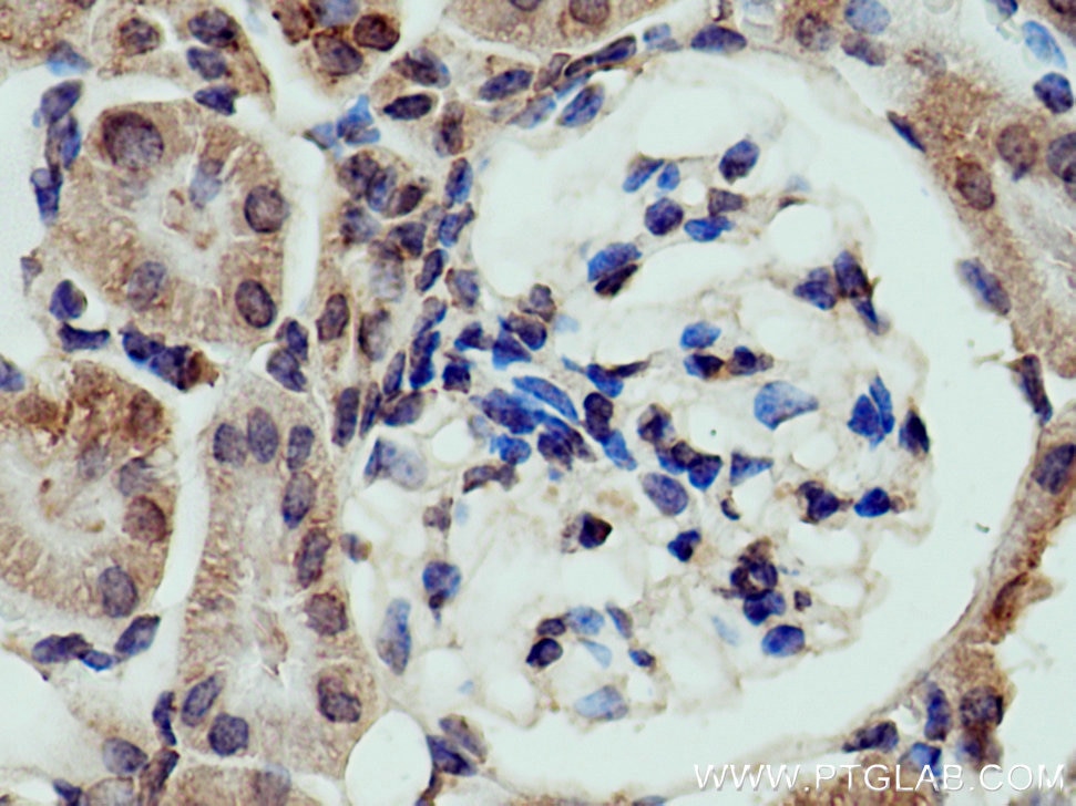 Immunohistochemistry (IHC) staining of mouse kidney tissue using PRR5 Polyclonal antibody (17948-1-AP)