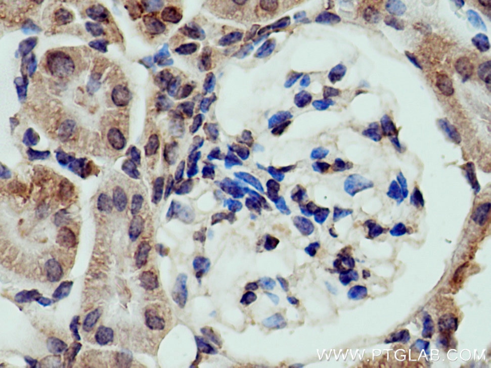 IHC staining of mouse kidney using 17948-1-AP