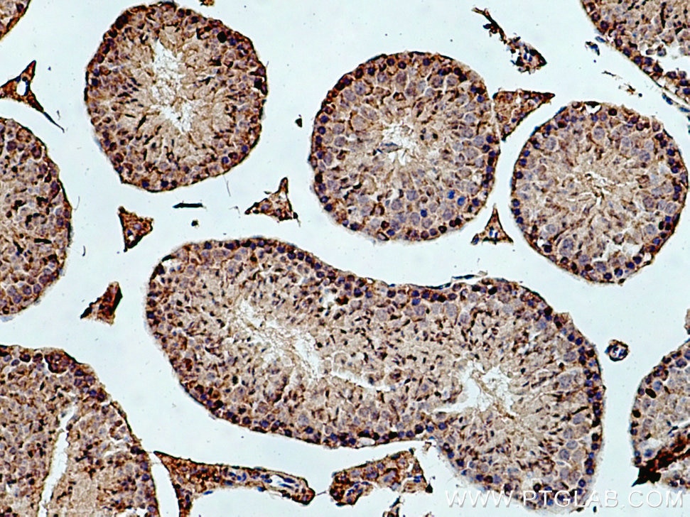 IHC staining of mouse testis using 17948-1-AP